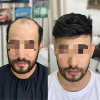 کارآموز آرایشگری مردانه و پروتز مو در آرایشگاه