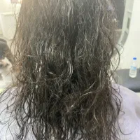 پاک سازی موی سر از شپش فقط با یک جلسه