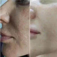 کرم معجزه اصل اصل|آرایشی، بهداشتی، درمانی|اهواز, پردیس دو|دیوار