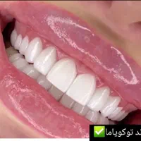 کامپوزیت دندان، روکش، دندانپزشکی تخصصی صدف تهرانسر|خدمات آرایشگری و زیبایی|تهران, تهرانسر مرکزی|دیوار