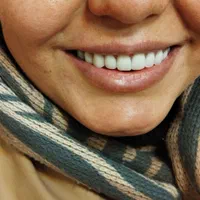 خدمات حرفه‌ای دندان مصنوعی با گارانتی