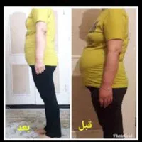 جشنواره لاغری تضمینی در۱۰روز فقط ۱۲۹ت/کرایولیپولیز|خدمات آرایشگری و زیبایی|اصفهان, احمدآباد|دیوار