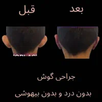 جراحی گوش با تخفیف ویژه