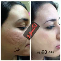 پوست هلویی زیبا بدون تزریق|آرایشی، بهداشتی، درمانی|اراک, |دیوار