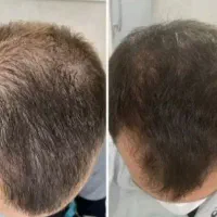 به فکر رویش باش تا به فکر کاشت نباشی
