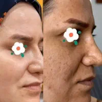 ضد لک بسیار قوی ی ی ی