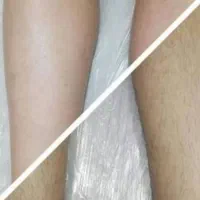 اپیلاسیون کل بدن فقط۵۵۰ آموزش یک تومن و پدیکور ۴۰۰