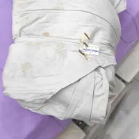 درمان هموروئید بواسیر