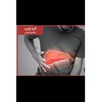 بهبود کبد چرب وسیروز کبدی و پاکسازی کبد|آرایشی، بهداشتی، درمانی|مینودشت, |دیوار