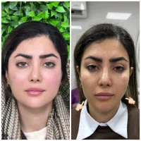 جشنواره تافردا)هایفوگلد فقط1/950با20خدمات رایگان