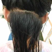 رفع قطعی شپش باداروی گیاهی وبدون عوارض