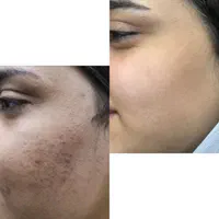 کرم ضدلک وایت رز ضد لک روشن کننده ژل شستشو|آرایشی، بهداشتی، درمانی|شیراز, احمدی جنوبی|دیوار