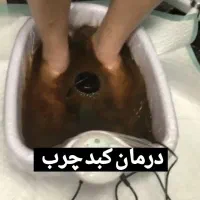 ابرو/لیزر پوست /شیدینگ/لیزر مو سفید/درمان کبد چرب|خدمات آرایشگری و زیبایی|خرم‌آباد, |دیوار