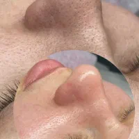 آموزش فیشال حرفه ای