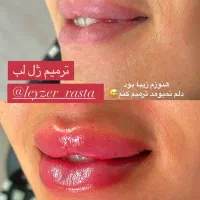 لیزر و زیبایی خمینی شهر|خدمات آرایشگری و زیبایی|خمینی‌شهر, |دیوار