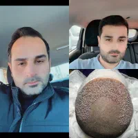 جشنواره کاشت‌مو پرتراکم