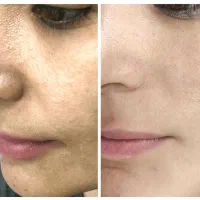 خدمات تاتو، کربن تراپی|خدمات آرایشگری و زیبایی|ساوه, |دیوار