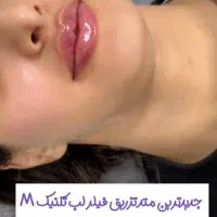 ژل ، بوتاکس ، چربی ، فیلر
