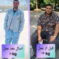 ساکشن و تزریق تمامی نقاط بدن...