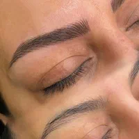 میکروبلیدینگ و شیدلب و دکاپاژ بجای ریمو