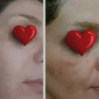 کرم معجزه اصل وانواع صابون|آرایشی، بهداشتی، درمانی|ایلام, |دیوار