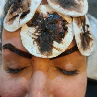 ریموو تتوی قدیمی بدون آسیب .تضمینی