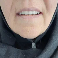 دندان ،دندان مصنوعی