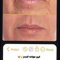 فروش میلیونی دریک روز|استخدام درمانی، زیبایی، بهداشتی|میاندوآب, |دیوار