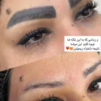 ریموور تخصصی  تاتو با مواد اصل آمریکایی با ضمانت