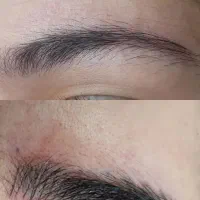 فیبروز و میکروبلیدینگ ابرو و تتو بدن