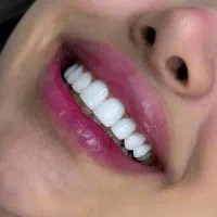 خدمات دندانپزشکی در کلینیک بصورت اقساطی در اردبیل