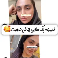 چاقی صورت و بدن تضمینی|خوردنی و آشامیدنی|طبس, |دیوار