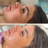 تخفیف فوق العاده (فیشال تخصصی پوست)