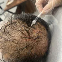 لیزردرمجهزترین،کاملترین کلینیک باحضور اشا محرابی|خدمات آرایشگری و زیبایی|قم, زنبیل آباد|دیوار