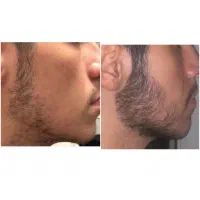 مثل انار رسیده، پُر و پیمون شو