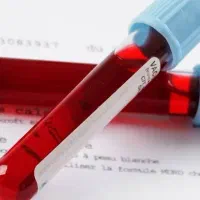 تفسیر تخصصی آزمایش خون،توسط دکتر