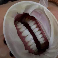 جشنواره ی دندانپزشکی/ عصب کشی و ترمیم ۵ تومان