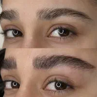 میکروبلیدینگ وشیدینگ لب