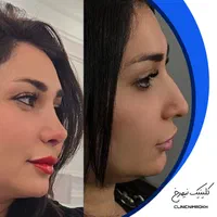 عمل بینی کمتر از ۲۵ میلیون|خدمات آرایشگری و زیبایی|تهران, نظامی گنجوی (توانیر)|دیوار