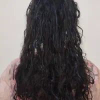 تخفیف پروتیین و بوتاکس