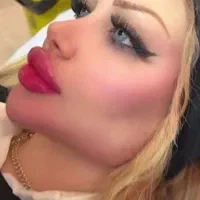ژل لب و فول فیس ۳۷۰هزار تومان توسط پزشک کلینیک|خدمات آرایشگری و زیبایی|کرج, گوهردشت|دیوار