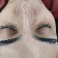 فیشال تخصصی پاکسازی۲۰۰تومان مزو کربوکسی اسیدتراپی|خدمات آرایشگری و زیبایی|مشهد, هدایت|دیوار
