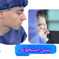 جراحی بینی دربیمارستان|خدمات آرایشگری و زیبایی|تهران, میدان ولیعصر|دیوار