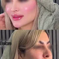 زیبایی و جراحی بدن،اسلیو معده،لیپو،ژل،بوتاکس