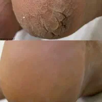 اسپا دست وپا