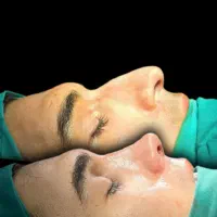 جشنواره عمل جراحی بینی فقط 23|خدمات آرایشگری و زیبایی|تهران, سعادت‌آباد|دیوار