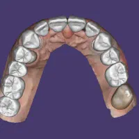 جذب نیروی کار خانم در لابراتوار دندانسازی