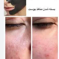 پاککردن تتوی بدن و روشن شدن بیکینی و زیربغل وصورت|خدمات آرایشگری و زیبایی|یاسوج, |دیوار