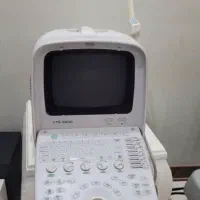 سونوگرافی