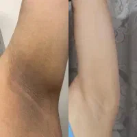 پاکسازی بدن